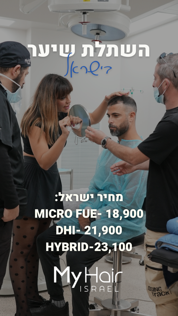 מחיר השתלת שיער בישראל